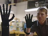 17 yr old boy prosthetics 17 yr old boy prosthetics